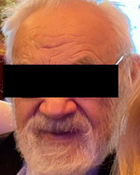 86-летний стрелок, В подъезде пенсионер выстрелил в шею соседу из самодельного пистолета
