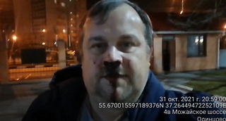 Житель «Гусарской баллады» Андрей Косяков после нападения мигрантов