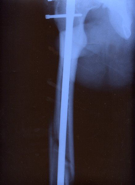 Правая нога